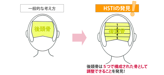 HSTIの発見(後頭骨)