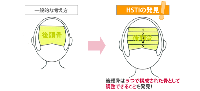 HSTIの発見（後頭骨）