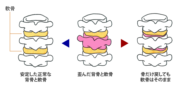 HSTIの発見(後頭骨)