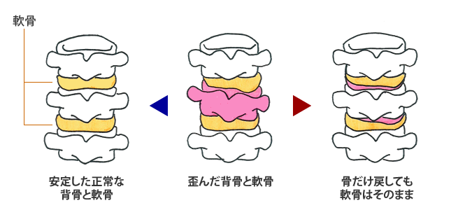 HSTIの発見（後頭骨）